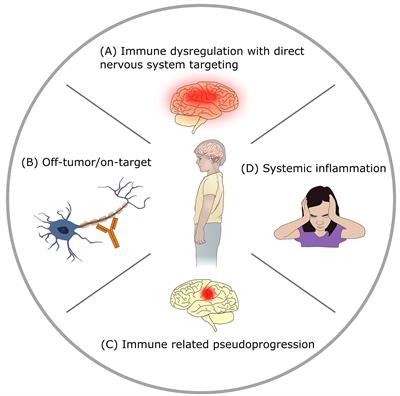 Immunotherapy Associated Neurotoxicity in Pediatric Oncology